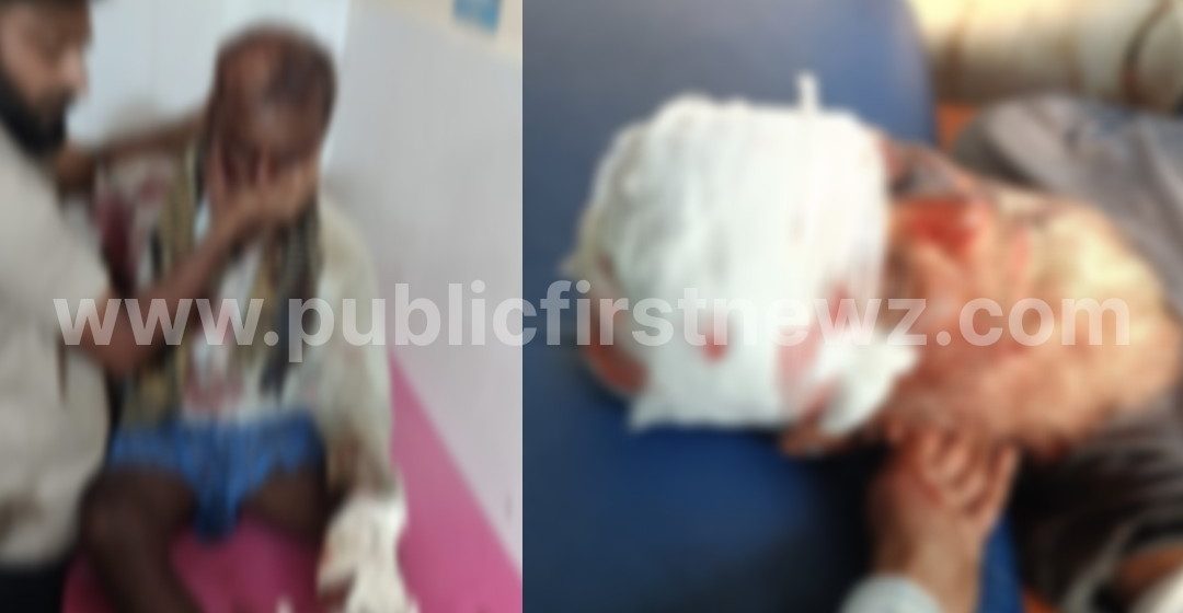 ಗಣೇಶಪುರದ ರೈತನ ಮೇಲೆ ಕರಡಿ ದಾಳಿ ಕೇಸ್, ಕಿಮ್ಸ್ ಗೆ ಭೇಟಿ ನೀಡಿ ಗಾಯಾಳುವಿನ ಆರೋಗ್ಯ ವಿಚಾರಿಸಿದ ಮುಂಡಗೋಡ RFO..! ಗಣೇಶಪುರದ ರೈತನ ಮೇಲೆ ಕರಡಿ ದಾಳಿ ಕೇಸ್, ಕಿಮ್ಸ್ ಗೆ ಭೇಟಿ ನೀಡಿ ಗಾಯಾಳುವಿನ ಆರೋಗ್ಯ ವಿಚಾರಿಸಿದ ಮುಂಡಗೋಡ RFO..!