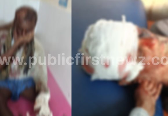 ಗಣೇಶಪುರದ ರೈತನ ಮೇಲೆ ಕರಡಿ ದಾಳಿ ಕೇಸ್, ಕಿಮ್ಸ್ ಗೆ ಭೇಟಿ ನೀಡಿ ಗಾಯಾಳುವಿನ ಆರೋಗ್ಯ ವಿಚಾರಿಸಿದ ಮುಂಡಗೋಡ RFO..!