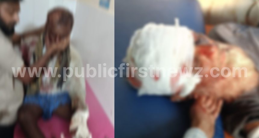 ಗಣೇಶಪುರದ ರೈತನ ಮೇಲೆ ಕರಡಿ ದಾಳಿ ಕೇಸ್, ಕಿಮ್ಸ್ ಗೆ ಭೇಟಿ ನೀಡಿ ಗಾಯಾಳುವಿನ ಆರೋಗ್ಯ ವಿಚಾರಿಸಿದ ಮುಂಡಗೋಡ RFO..!