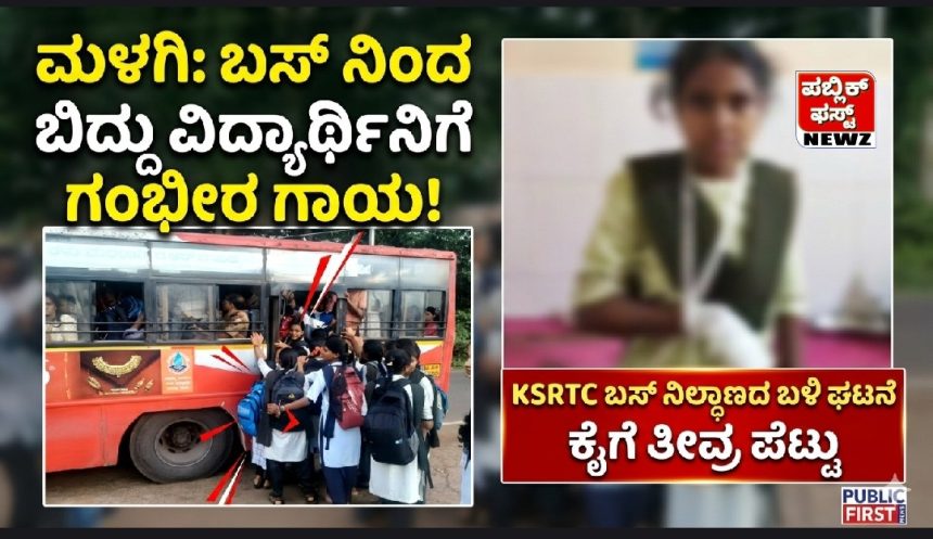 ಮಳಗಿ ಹೊಸ ಬಸ್ ನಿಲ್ದಾಣದ ಬಳಿ, KSRTC ಬಸ್ ನಿಂದ ಬಿದ್ದು ವಿದ್ಯಾರ್ಥಿನಿಯ ಕೈಗೆ ಗಂಭೀರ ಗಾಯ..!